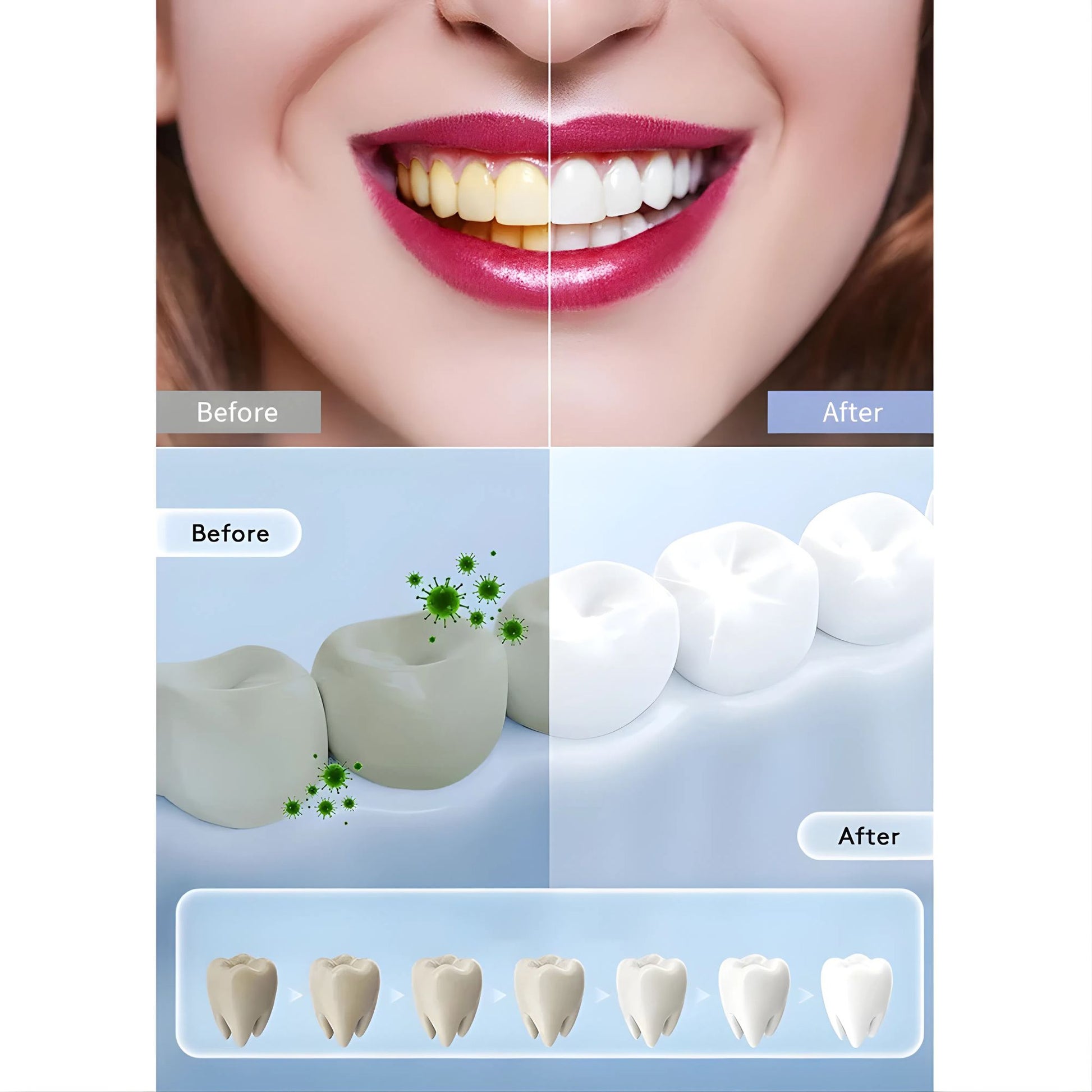 Modo de uso del tratamiento blanqueador BrightLite Oralhoe
